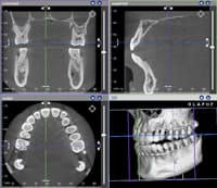 顎関節の正確な観察や矯正歯科以外の治療にも役立つ